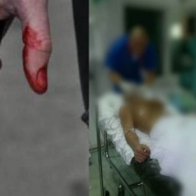 VÂLCEA: Un bărbat surdo-mut a fost înjunghiat de mai multe ori